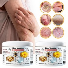 1-3PCS Bee Venom Multi-Symptom