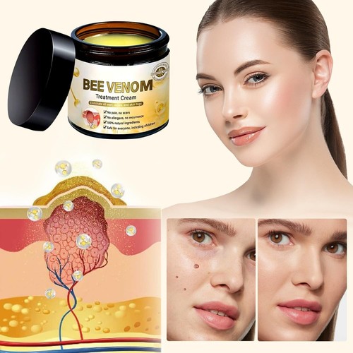 120g bee venom treatment - x,