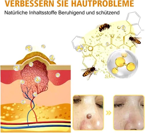 Bee venom treatment - venom,