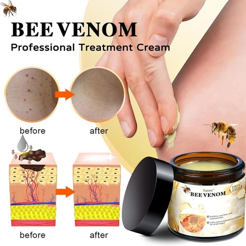 Bee venom treatment cream - bee,