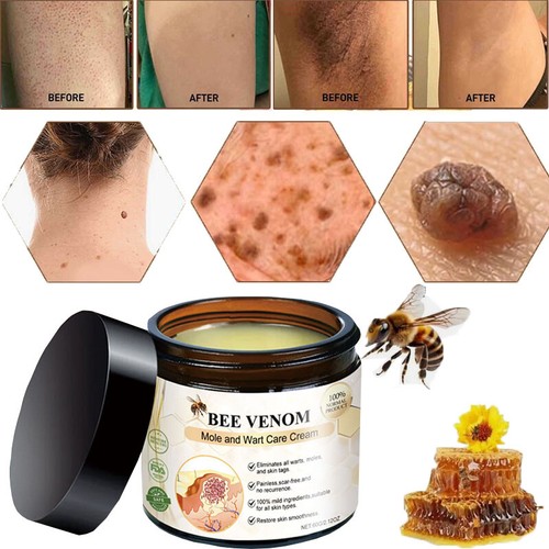 Bee venom comprehensive cream - bee,